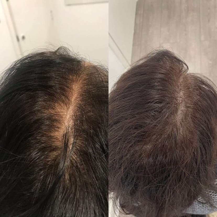 Density — Simply Scalp client work