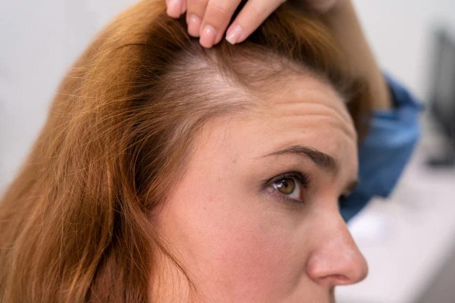 What menopausal hair thinning really calls for