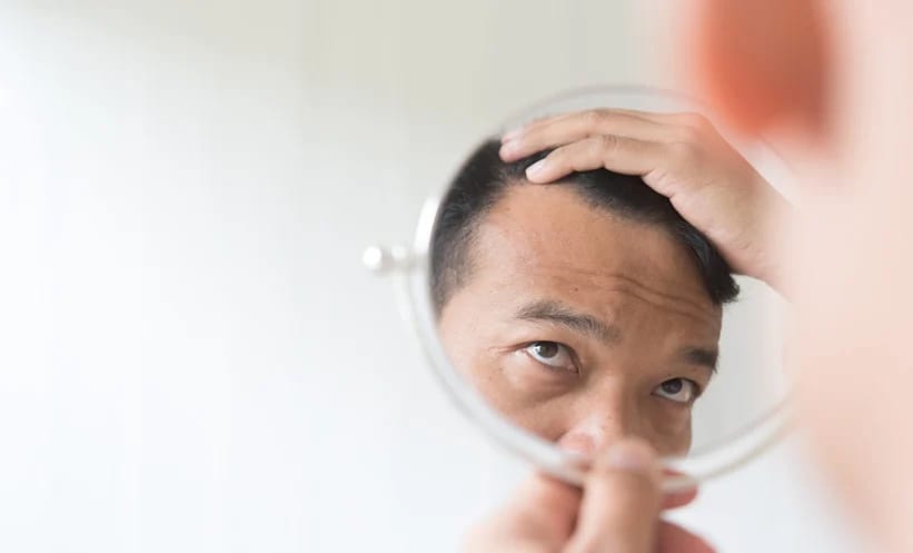 What to expect across your sessions — scalp micropigmentation at Simply Scalp
